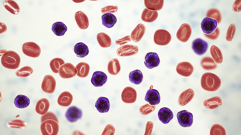 leukemia cells
