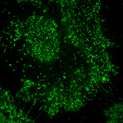 A dividing HeLa cell captured using the MU Molecular Cytology Core.
