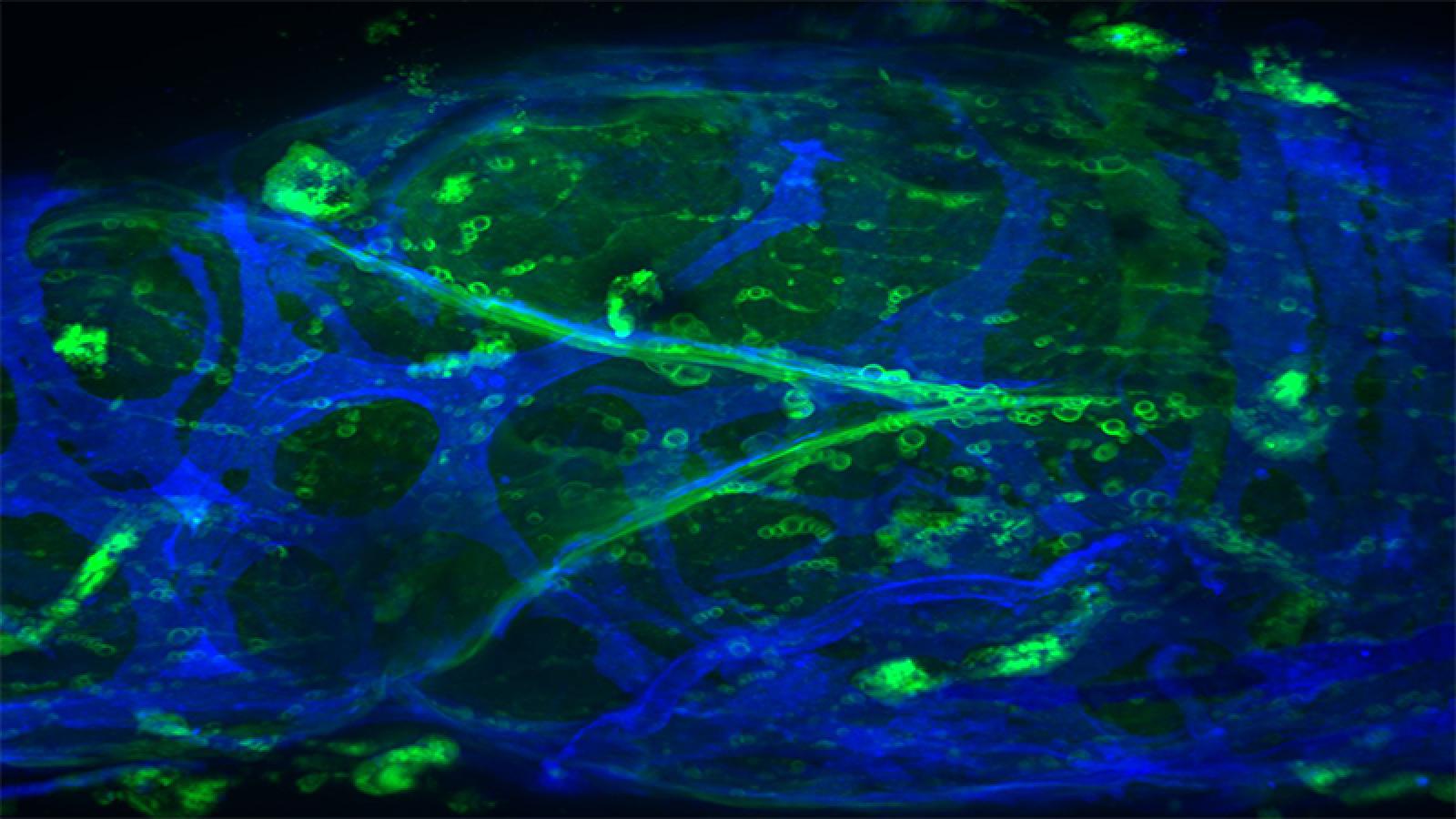 lymphatic valve slide photo