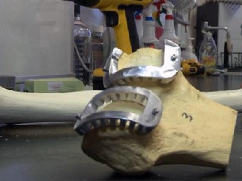 cartilage transplant