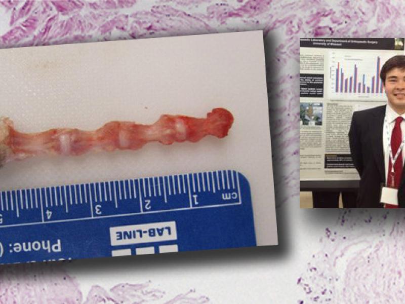 North American Spine Society’s 28th Annual Meeting  