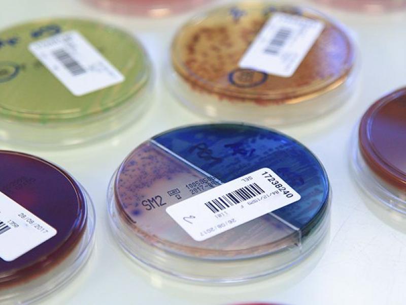 Research Petri dish