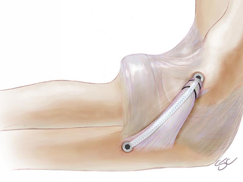 American Orthopaedic Association’s top poster